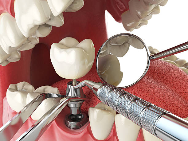 Best Cracked Tooth Emergency Dentist  in Elk River, MN